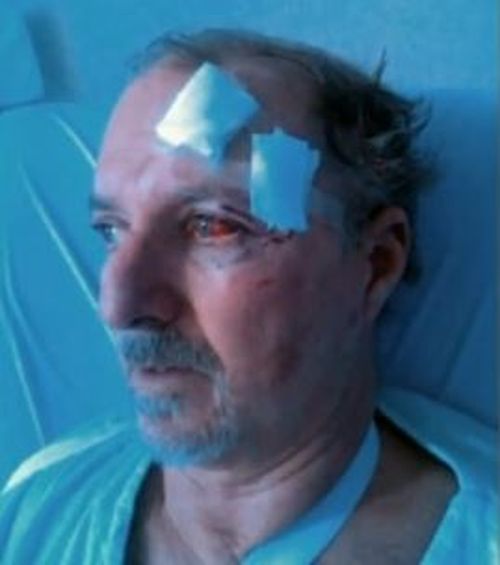 He was rushed to The Alfred hospital after he was bashed by two armed thugs in his driveway in August. (Picture: supplied)