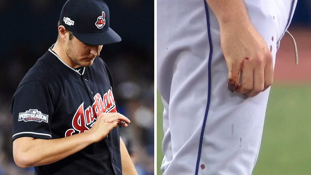 Baseball: Pitcher battles to play with bloodied hand