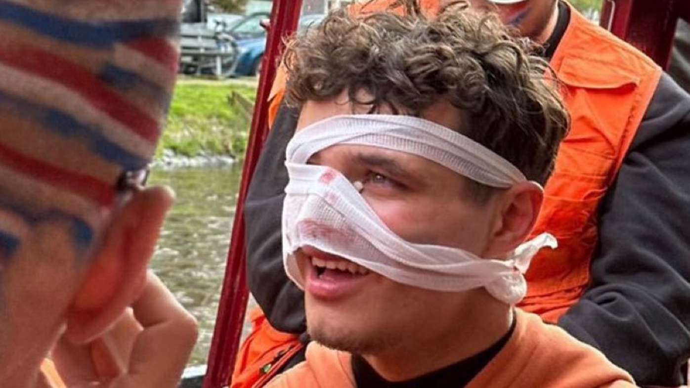 Lando Norris captured with heavy bandaging after reportedly cutting his nose with broken glass at Amsterdam