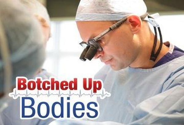 Botched Up Bodies