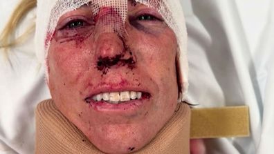 Chloe, a celebrity photographer, was working inside her apartment when Lin walked in.