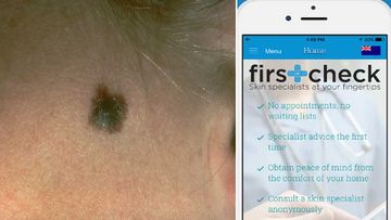 Skin cancer app helps Aussies detect melanomas with the tap of a finger