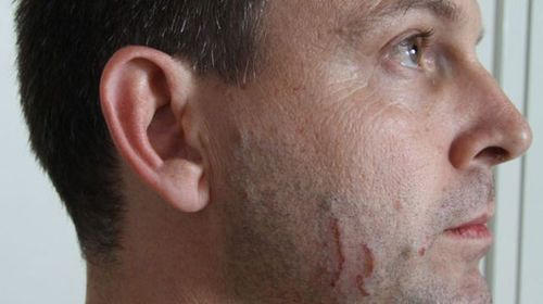 Baden-Clay told police the scratches on his face were from a shaving accident. (Queensland Police)