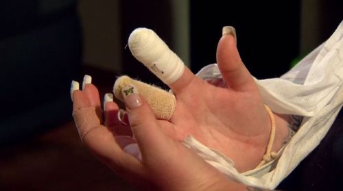 Young mum, Chloe Holdway had two of her nails removed due to infection that she claims she got from a budget nail salon. (A Current Affair)