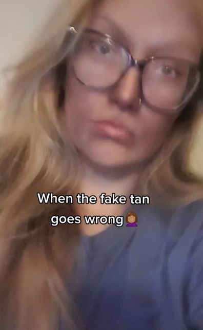Woman shocked after fake tan turns her skin blue
