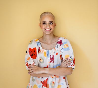 Julia Sandlant after losing her hair during cancer treatment.