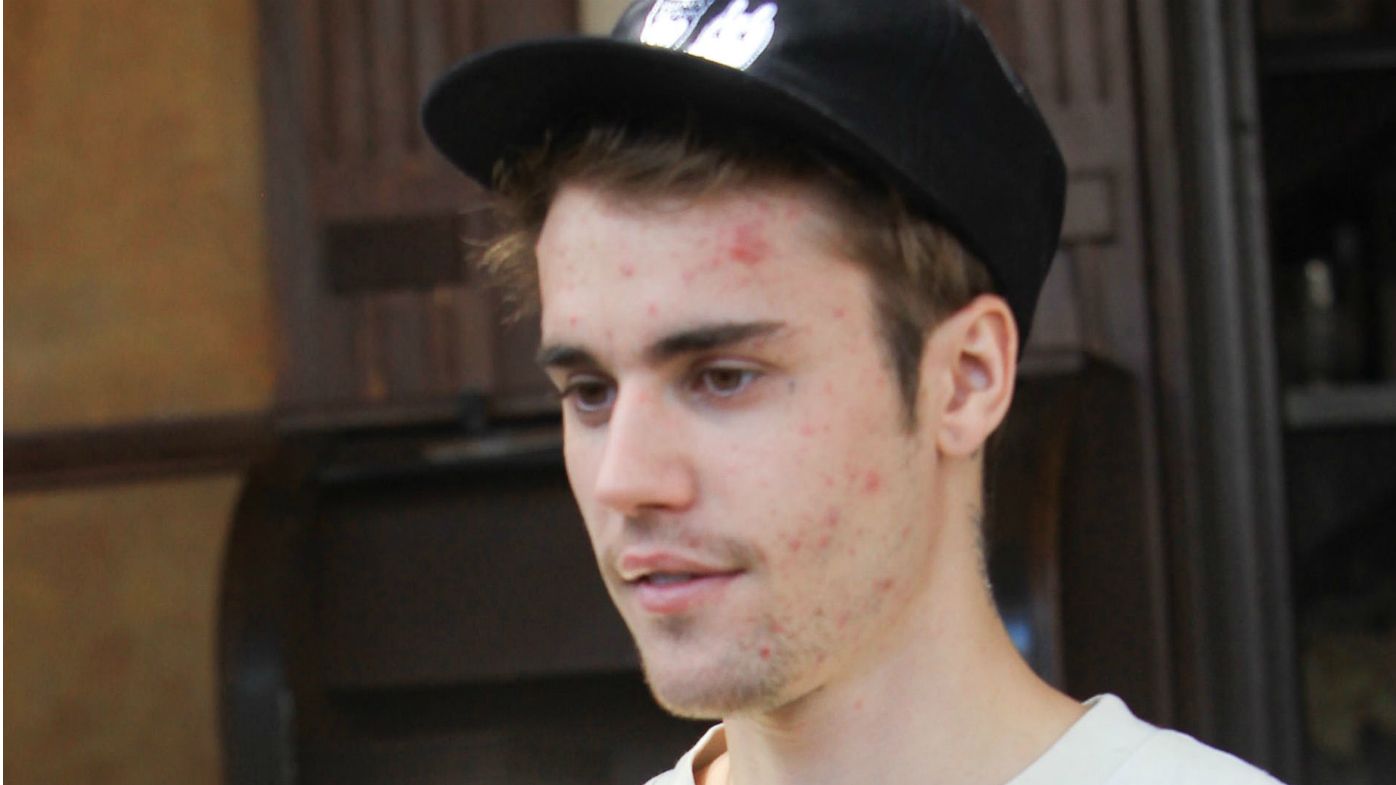 Justin Bieber reveals Lyme disease diagnosis 9Celebrity