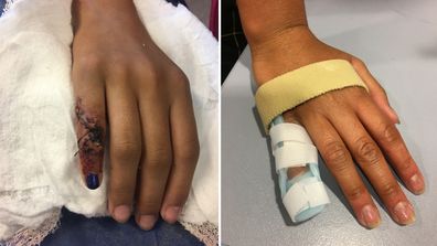 Pre-teen’s finger almost severed on Easter Show ride