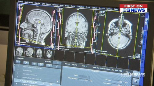 It is hoped the new study will allow researchers to track help further understanding of Alzheimer’s. (9NEWS)