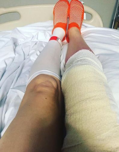 Anne cancer amputee Chris O'Brien Lifehouse 