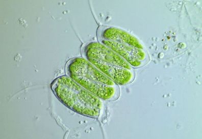 Chlorovirus ATCV-1