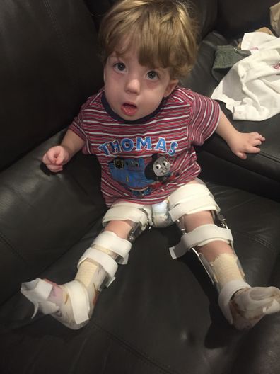 He was unable to use his legs until surgery when he was a toddler.