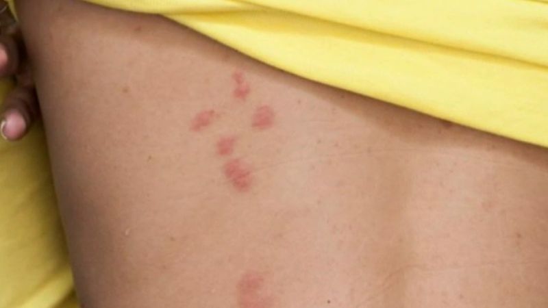 Rare virus detected for the second time in Australian history | Nine.com.au
