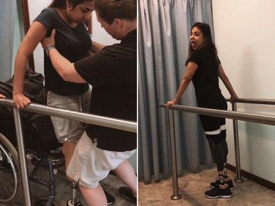 Juttima Chinnasri re-learning how to walk with prosthetics.