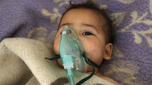 A Syrian child received treatment after the suspected toxic gas attack. (AFP)