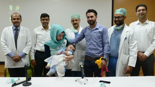 Baby born with eight limbs gets new lease on life in India
