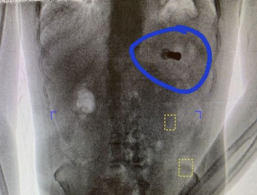 This undated body scan shows an apparent shotgun shell inside the body of a person who was being booked into the lockup. Prisoners entering the Morgan County Jail routinely undergo a body scan when being admitted.