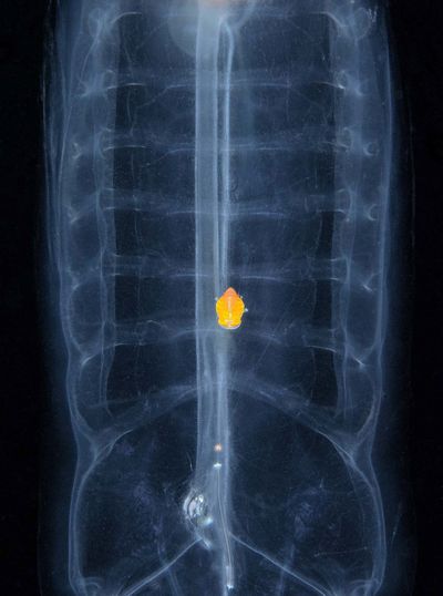 Highly commended in Underwater Category: Yat Wai So | X-ray