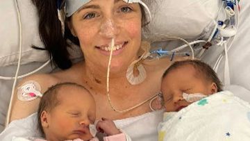 Melbourne mum Alexandra Judd was kept alive by an advanced form of life support reserved for ICU&#x27;s sickest patients after giving birth to twins Violet and Ester.