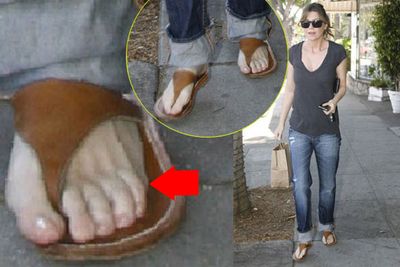 This photo sparked rumours that <i>Grey's Anatomy</i> star Ellen Pompeo has six toes. She later denied it, joking that she actually has seven toes! Of course the truth is she just has five.