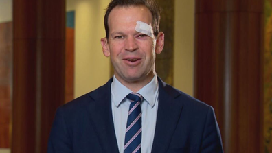 Matt Canavan busted head injury Parliament touch football