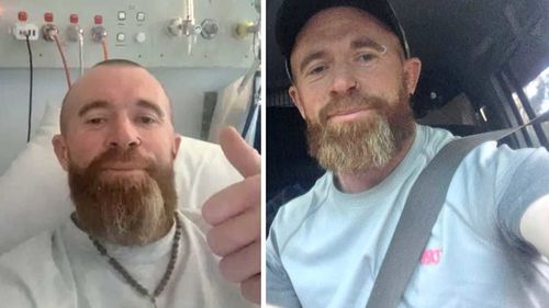 Al commerciante irlandese Noel Quinn è stato diagnosticato un melanoma il mese scorso.