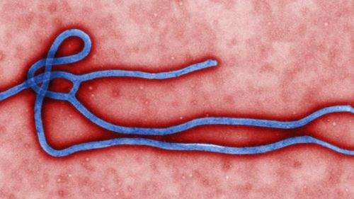 Up close and deadly - the Ebola virus kills almost 90% of victims. (Getty)