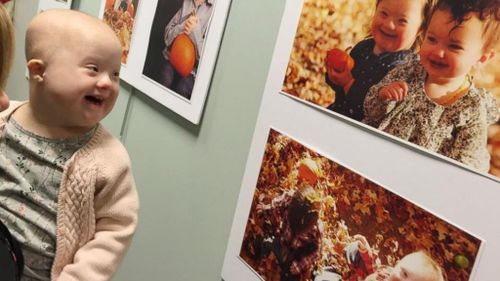 Young girl with cancer reacts with joy to old photo of herself with hair