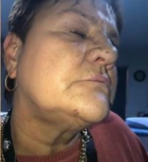 A victim of a violent road rage incident has spoken out about the peak hour attack, which left her with cuts and bruises to her face and hands