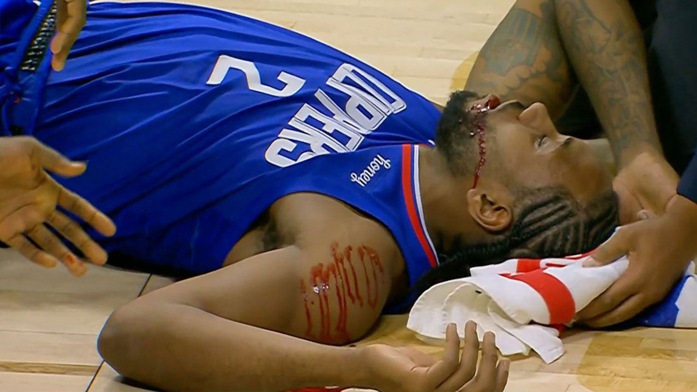 Kawhi Leonard leaves game with facial injury