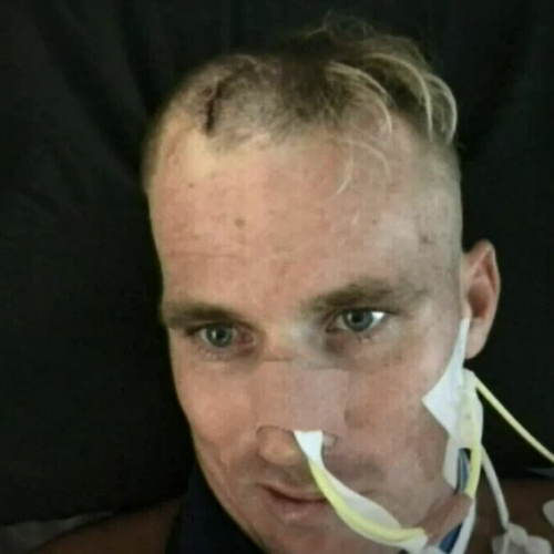 29-year-old Gold Coast tradie Brock Prime suffered brain damage from the attack. 