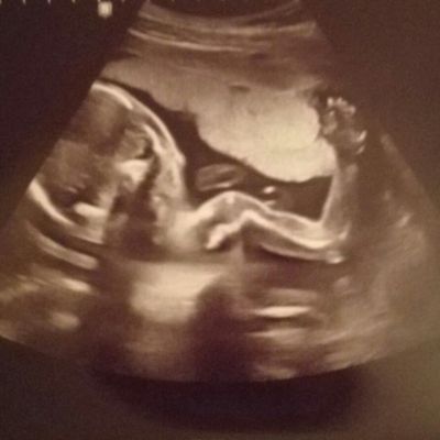 Funny and strange ultrasound photos parents have shared