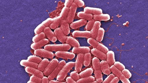 A strain of E. coli. (AFP file image)