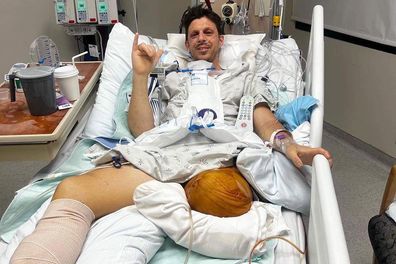 Dave Miln underwent 10 separate surgeries over three weeks following the incident in the US.