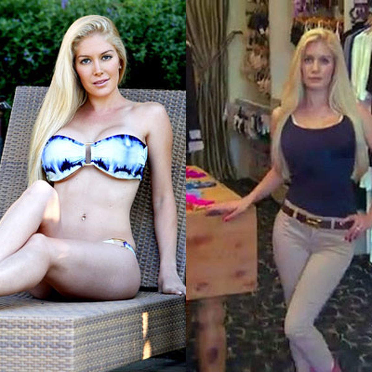 Heidi Montag on why she downsized her F-cup breasts: 'They nearly