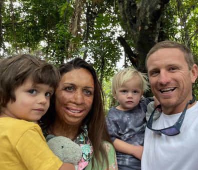 Turia Pitt and her partner Michael have you two young sons together.