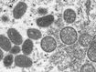 This electron microscopic image depicts a monkeypox virion, obtained from a clinical sample associated with the 2003 prairie dog outbreak.