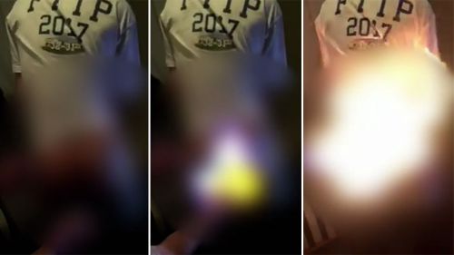 A lighter was held to the boy's backside before another person in the room aimed aerosol liquid at it, igniting a short-lived blaze (9NEWS)