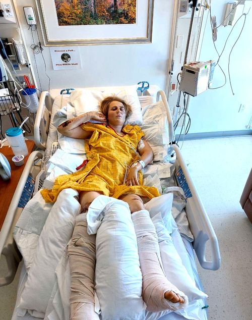 NZ climber Anna Parsons lies in a hospital bed in California.