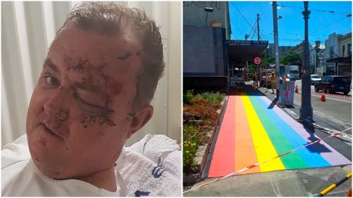 The 36-year-old was bashed on Smith Street, which is known to celebrate the LGBTI community. (Victoria Police/ Fitzroynet)