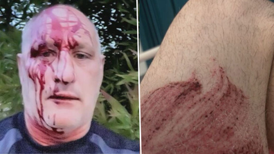 Patrick Reid Melbourne tradie robbed assaulted