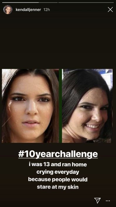 People Share Their Pics For The #10YearChallenge And Some Are