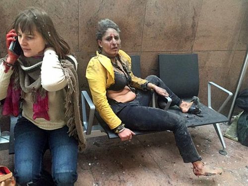 Woman in iconic Brussels bombing photo wakes from coma