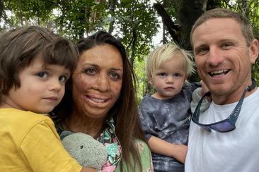 Turia Pitt and her partner Michael have you two young sons together.