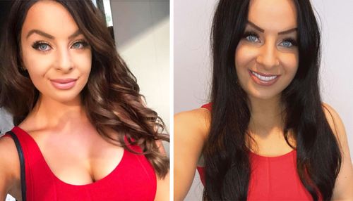 Charlotte Carrabs was 19 years old when she got her breast implants. She is pictured here before and after she got them removed in February.