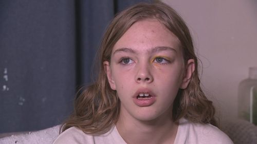 Jasmine Holub, 10, was left traumatised and covered in bruises after she was allegedly attacked outside the Ellenbrook McDonald's with her cousin yesterday.