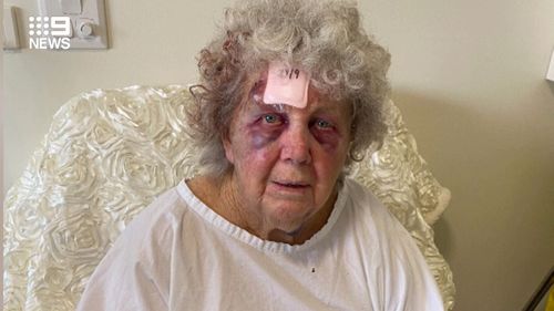 Mrs B was sent back to a nursing home while still wearing a hospital gown and with blood in her hair.