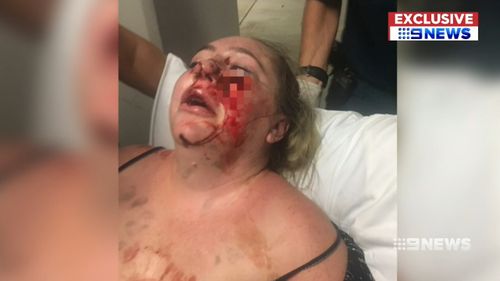 Rewi Borell is facing assault charges over the alleged attack on Emma Martin.