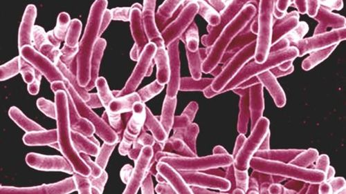 First Australian dies from drug resistant tuberculosis in Queensland