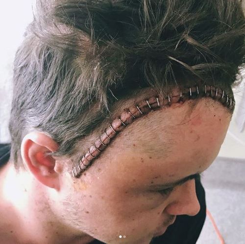 Actor and singer Johnny Ruffo has revealed he has almost fully recovered 10 months after a shock brain cancer diagnosis. Picture: Instagram/Johnny Ruffo.